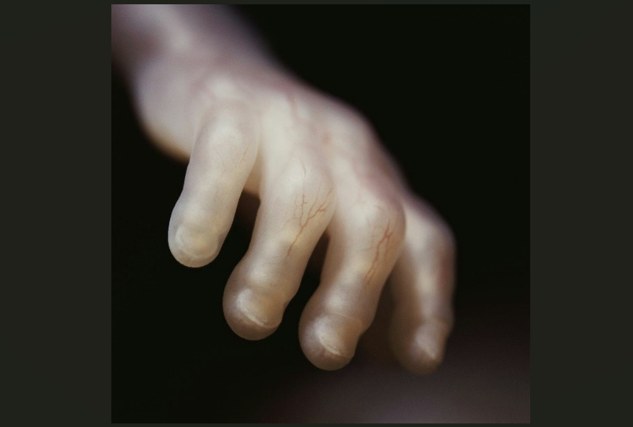 “Misoprostol-only” abortion - Guaranteed abortion access or further threat to women?