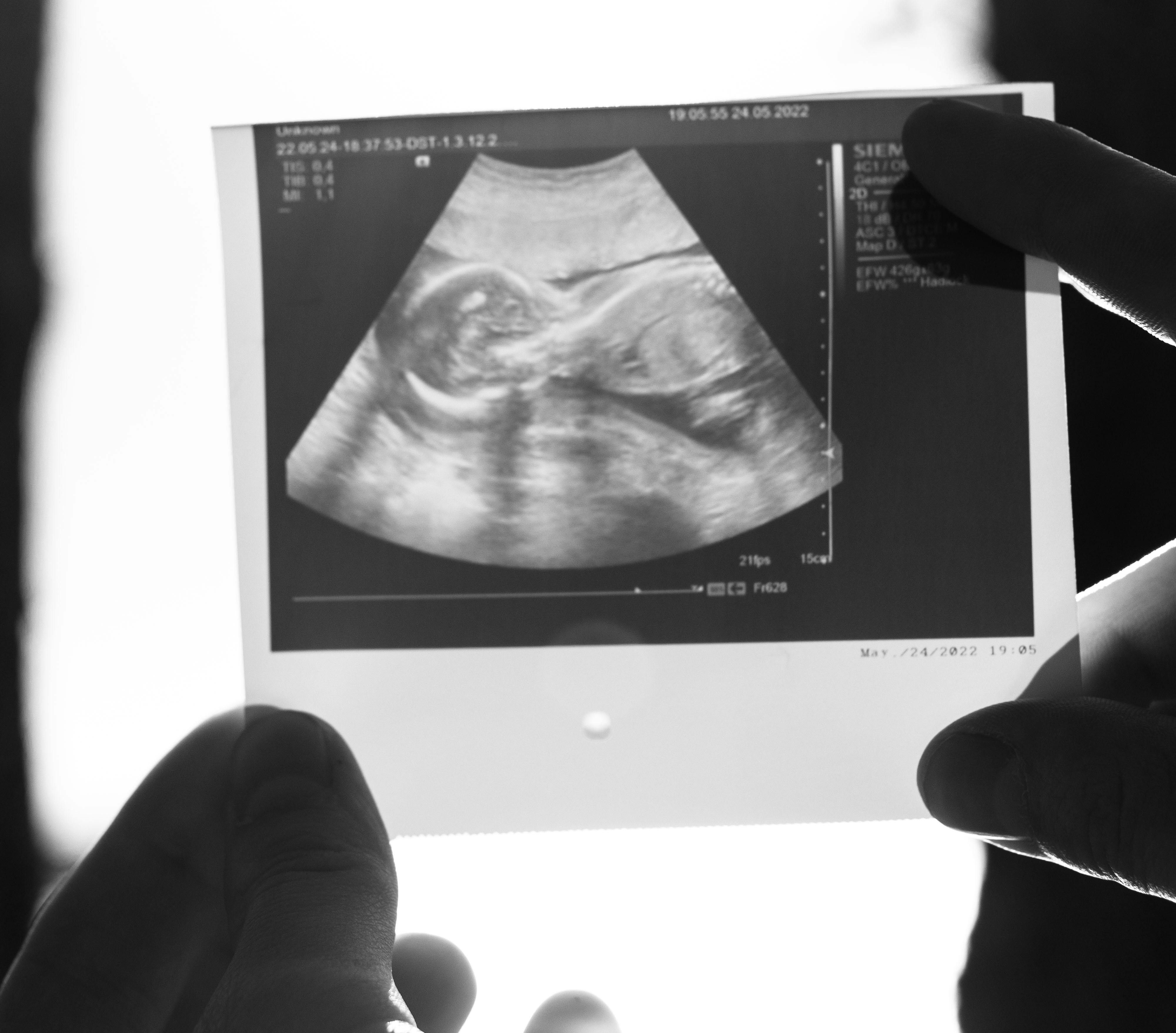 Wyo. governor signs abortion facility licensing law, vetoes another with ultrasound requirement