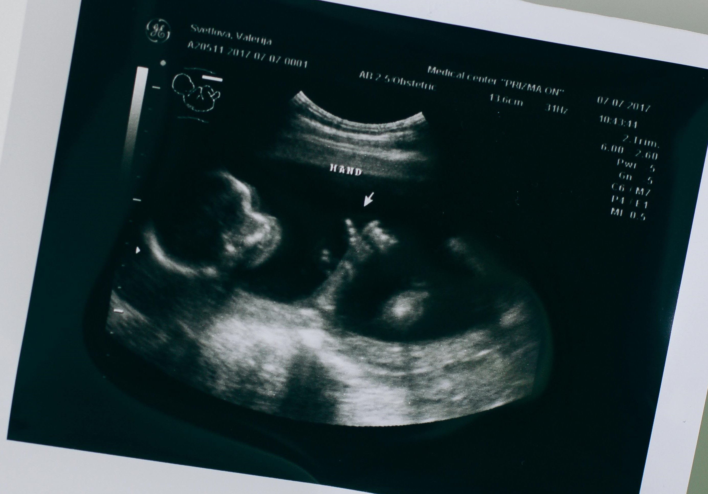 The abortion vulnerable church