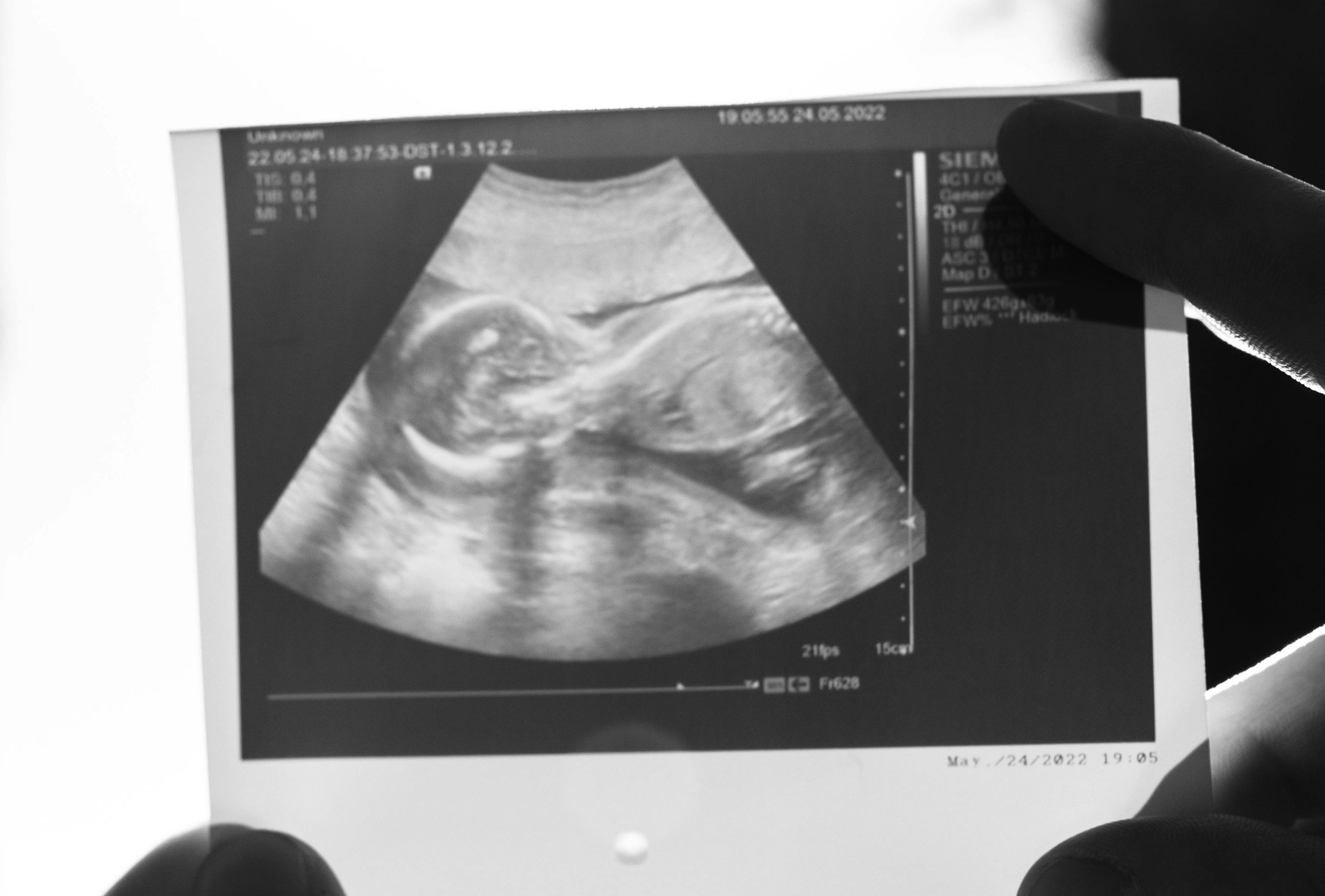 “This is not an abortion; it’s a rescue attempt” – radical Pa. abortion amendment advances propelled by “outrageous” abortion rhetoric. 