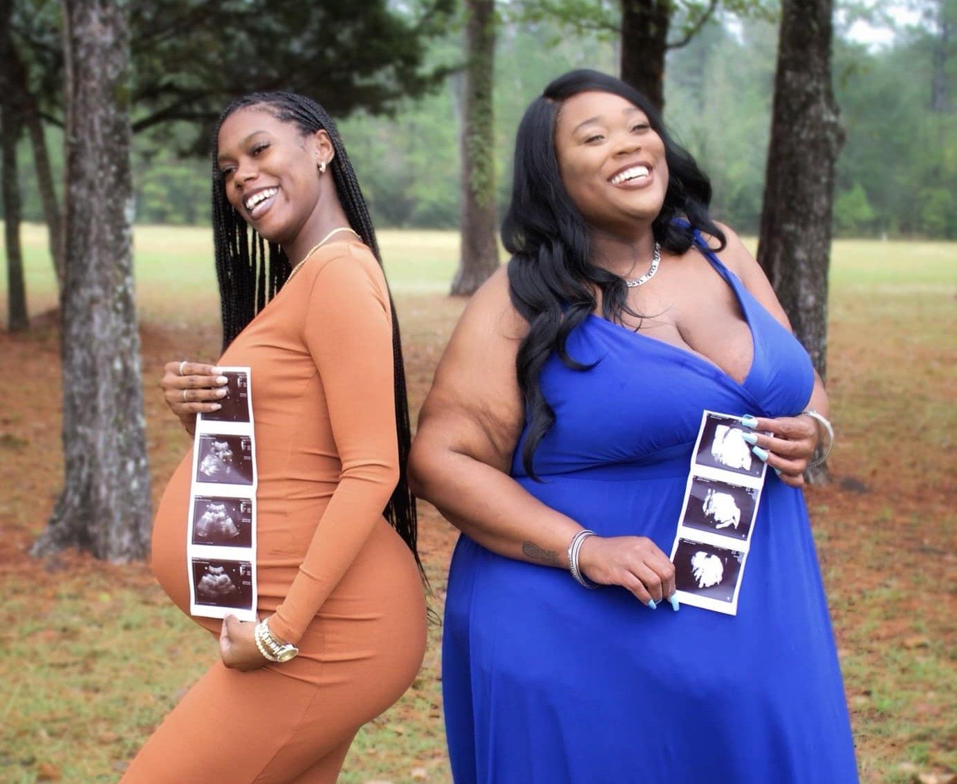  Pregnant moms have “joy-filled moment” with photo shoot