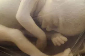 Unethical abortion pill study manufactures results