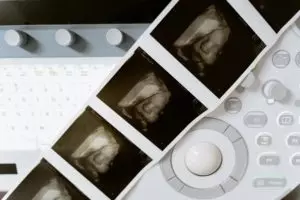 Most abortion used for birth control