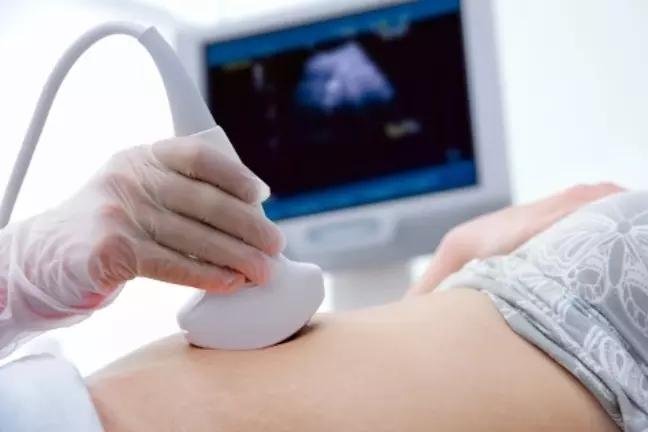 Nothing would ever be the same after seeing that sonogram