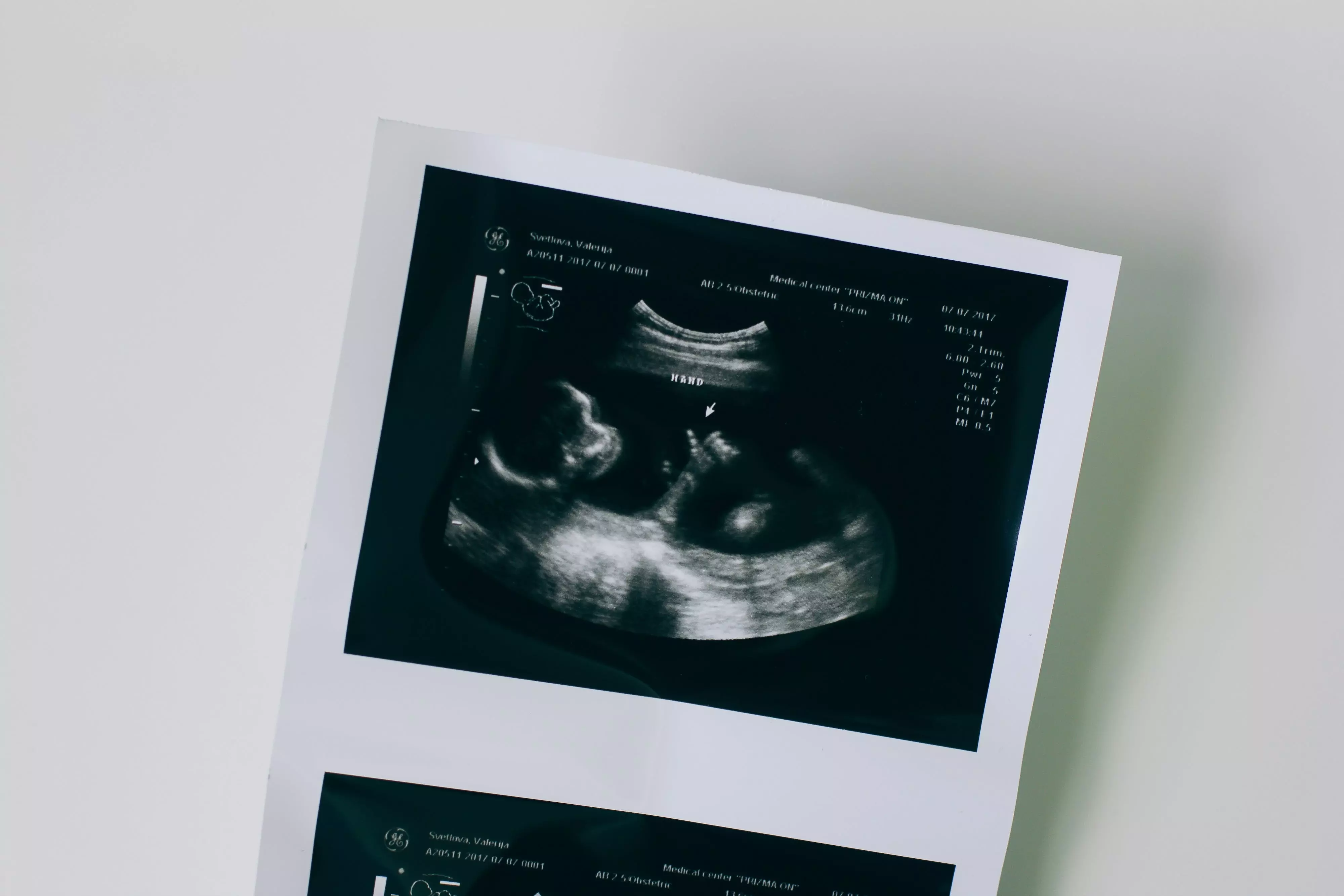Massachusetts officials push ‘Abortion Toolkit’ on campus