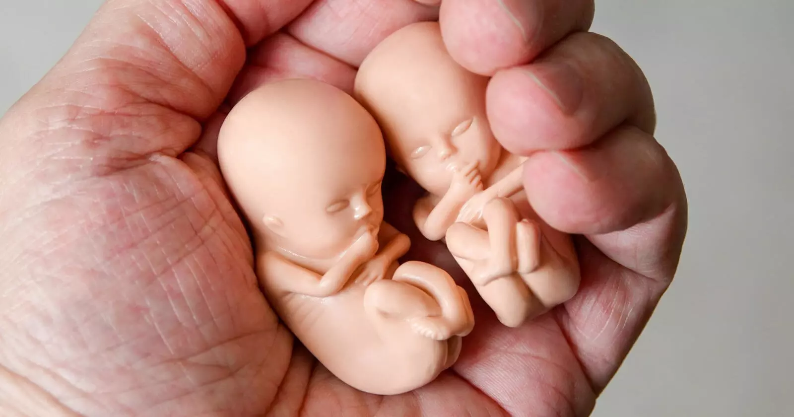 Abortion numbers increase in England and Wales as abortion campaigners call for abortion up to birth
