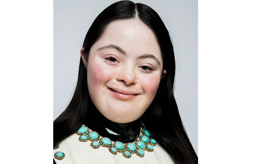 Ellie Goldstein 