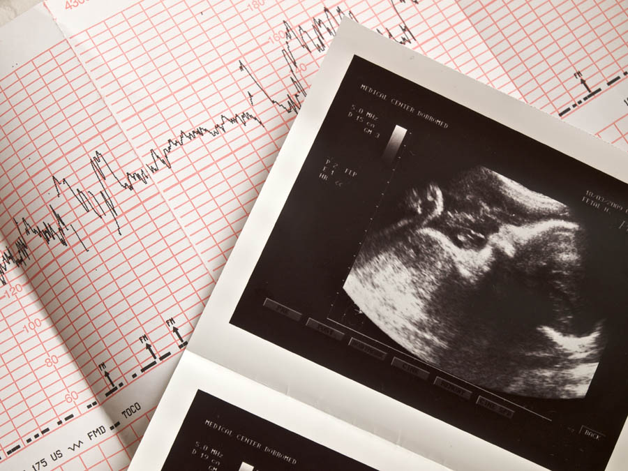 7 Ways Serving Pregnant Women Has Made Me a Better Christian