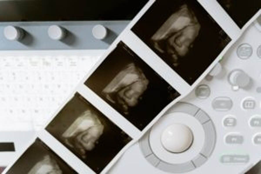 Most abortion used for birth control