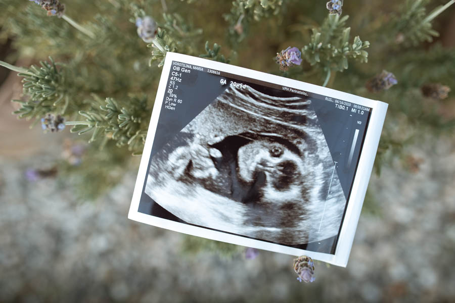 The pro-abortion media tricks and misleads because the truth is pro-life