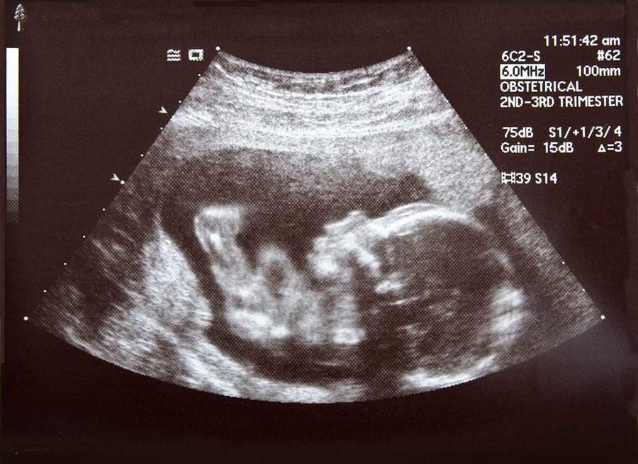 Are civil rights and reproductive rights comparable?