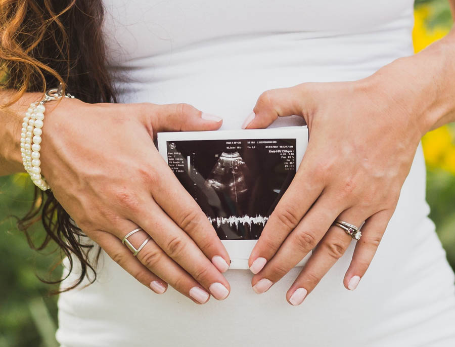 Supreme Court rejects ACLU challenge to Kentucky ultrasound law